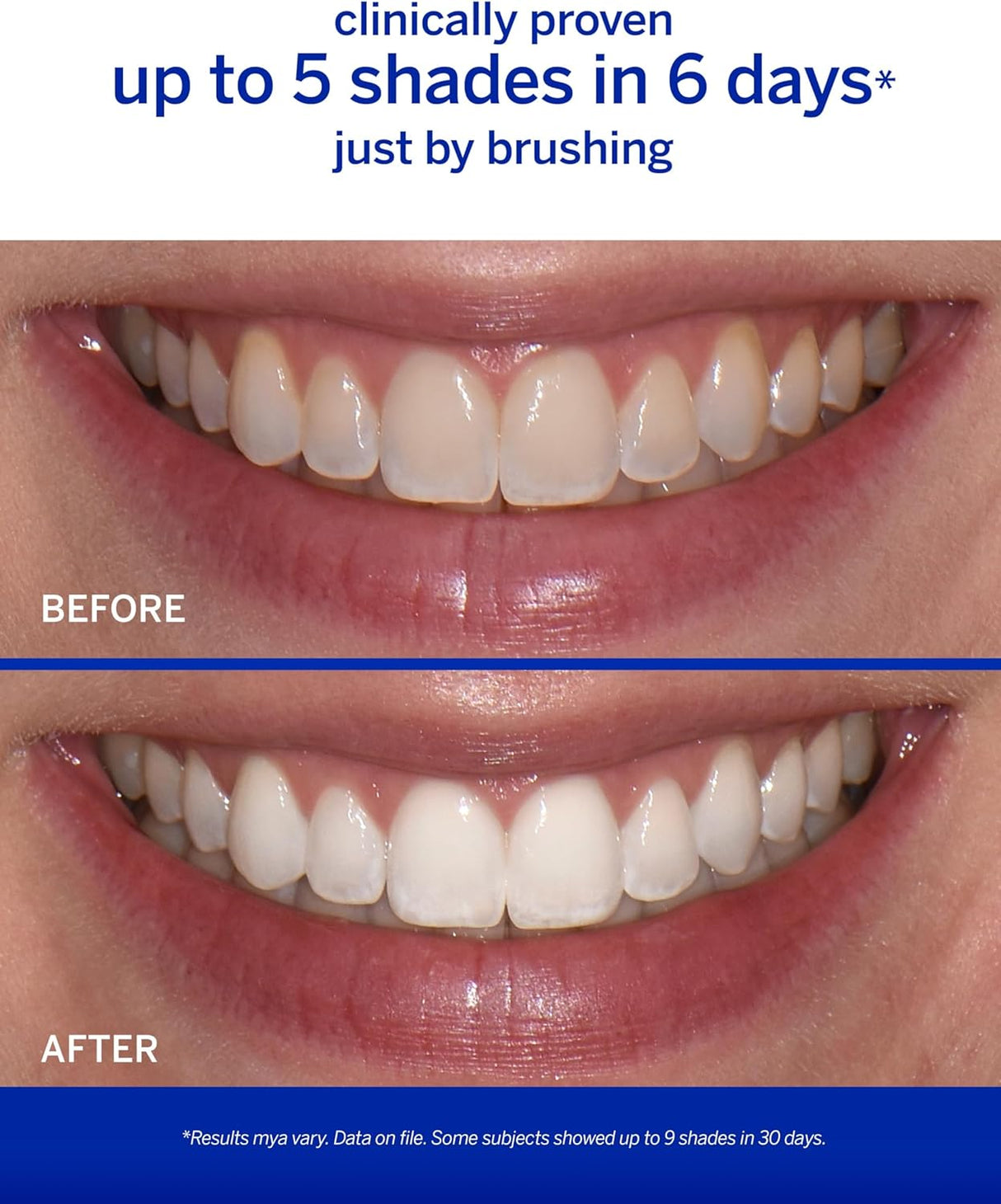 Supersmile The Works Whitening Toothpaste + Activator 198.5g - Whiter Smile