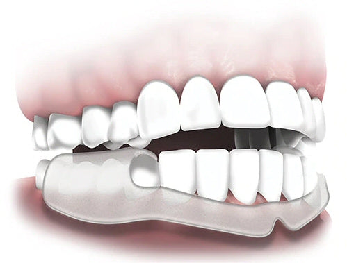 Plackers Grind-No-More Dental Night Protector (16 pack) Plackers