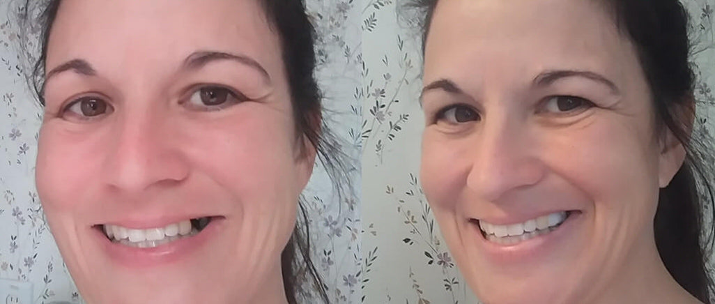 TempTooth Kit (Free Dental Tools) TempTooth