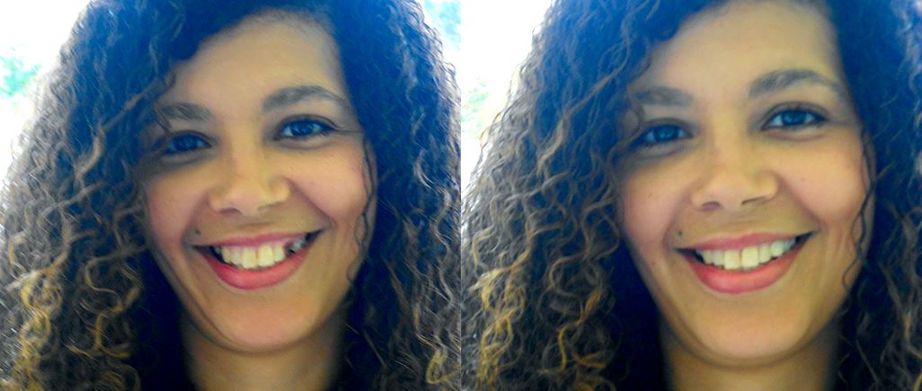 TempTooth Kit (Free Dental Tools) TempTooth