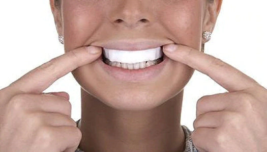 Premium Mouth Trays (2 Trays) + FREE 3 x Backup Trays Whiter Smile