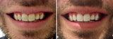 Teeth Whitening Gel Wholesale (3 Large Tubes) Minimum Order 6 Wholesale 