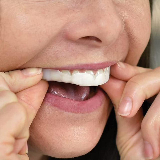 SleepRight ProRx Custom Dental Guard