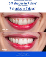 Supersmile Professional Whitening System (Fluoride Free)