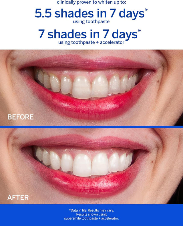Supersmile Professional Whitening System (Fluoride Free)
