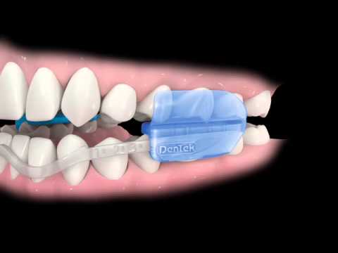 DenTek Comfort Fit Night Dental Guard