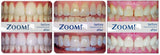 Philips ZOOM! Day White Gel 6% HP + Mouth Trays, Case & Whitening Pen Philips ZOOM 