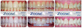 Philips ZOOM! Nite White Gel 16% CP (Mint) Philips ZOOM 