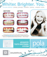 SDI PolaNight Whitening Gel 16% CP (Mint) SDI 