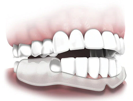 Plackers Grind-No-More Dental Night Protector (16 pack) Plackers 
