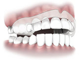 Plackers Grind-No-More Dental Night Protector (16 pack) Plackers 