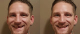 TempTooth Kit (Free Dental Tools) TempTooth 